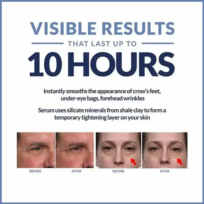 Instant Eye Bag Removal Cream Collagen Removal Wrinkles Lifting Fade Fine Lines Moisturizing Brightening Anti Puffiness Eye Care - view 5