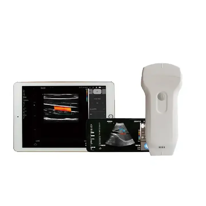 Double Probes cardiology Color Doppler Ultrasound Scanner 3 in 1 cardiac linear convex abdominal wireless android ultrasound