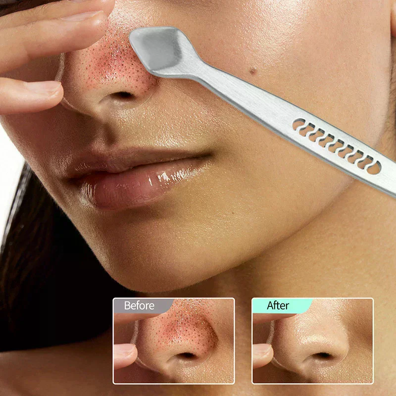 أداة إزالة الرؤوس السوداء ذات الرأس المزدوج من الفولاذ المقاوم للصدأ أدوات إزالة حب الشباب والزهم للعناية ببشرة الوجه