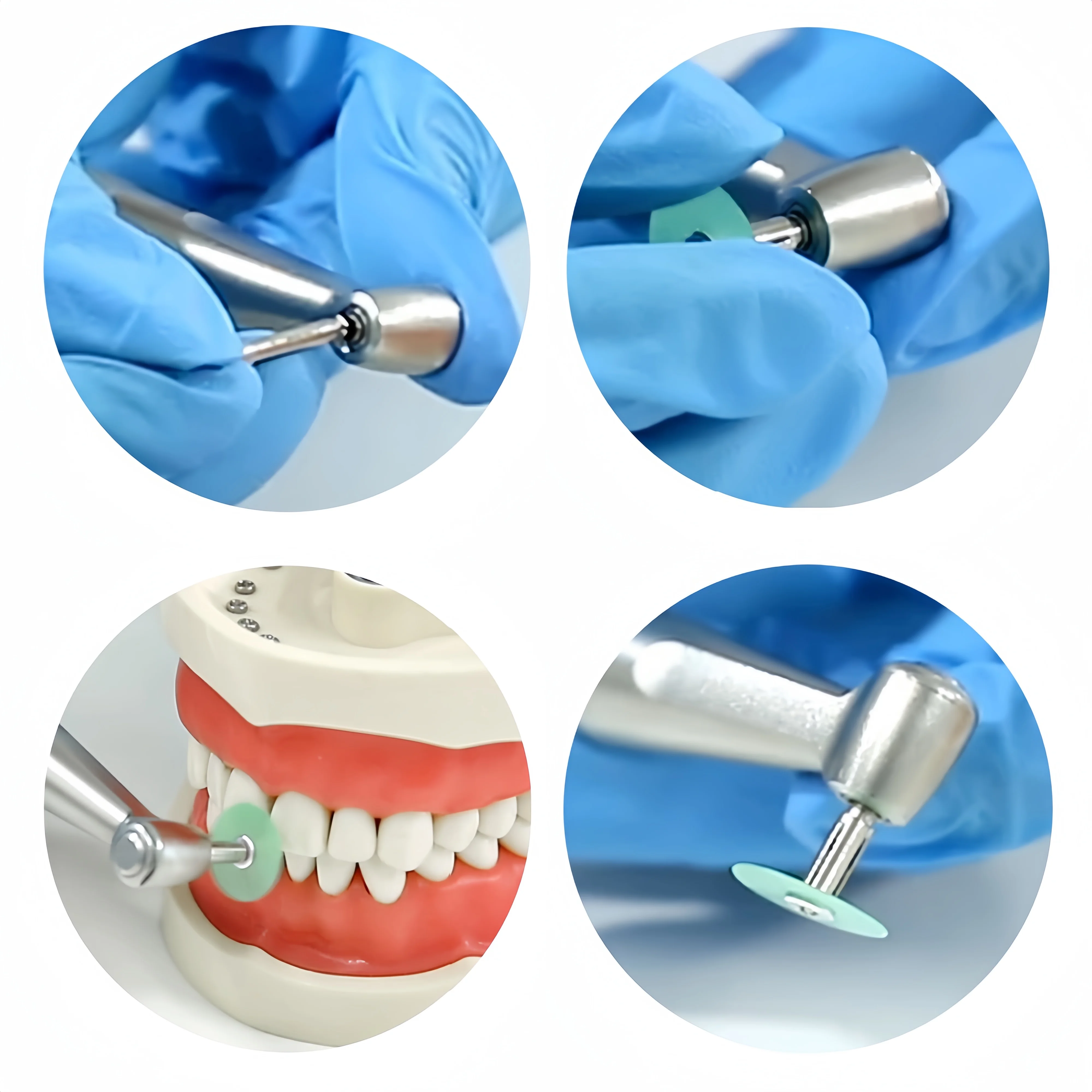 

40/80Pcs Dental Polishing Discs Set - Gross Reduction & Contouring Mandrel Stripes for Teeth Whitening & Restoration