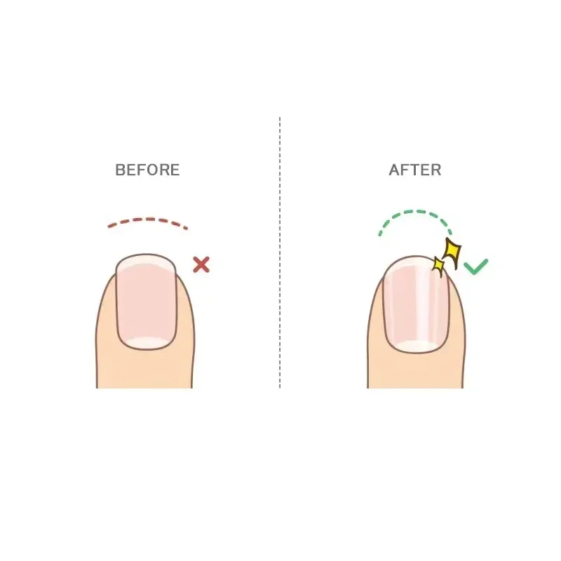 202452 --- مبرد أظافر غير لامع من الجلد الميت باللون الأسود من الزجاج النانوي، مقشر عالي الكثافة ومنتج جديد للبشرة الميتة #5