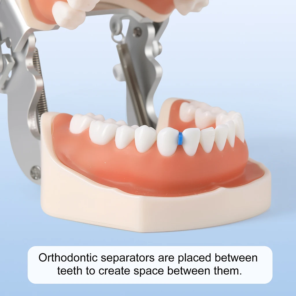 1000 Stück/Packung AZDENT Dental Kieferorthopädische Separatorbänder Elastische Gummibänder Zahnmedizinisches Material zur Erweiterung des Zahnraums – Detail 2