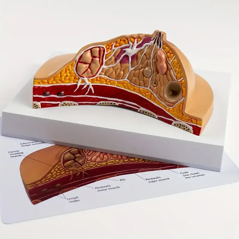 Artificial Human Pathological female Breast Model - Medical Disease & Cancer Anatomical models