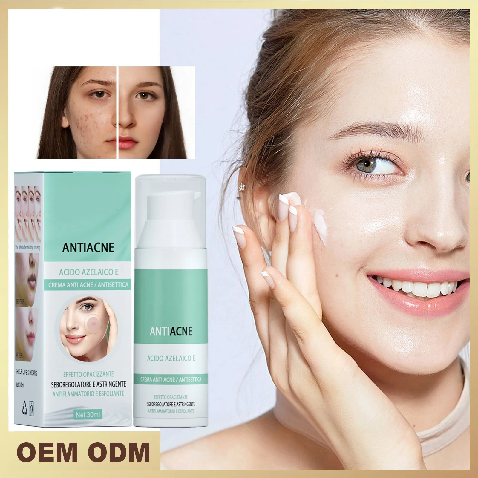 Acne Cream, Facial Cleansing And Acne Cleansing Cream, Gentle Acne Removing And Brightening Facial Skin Care Cream