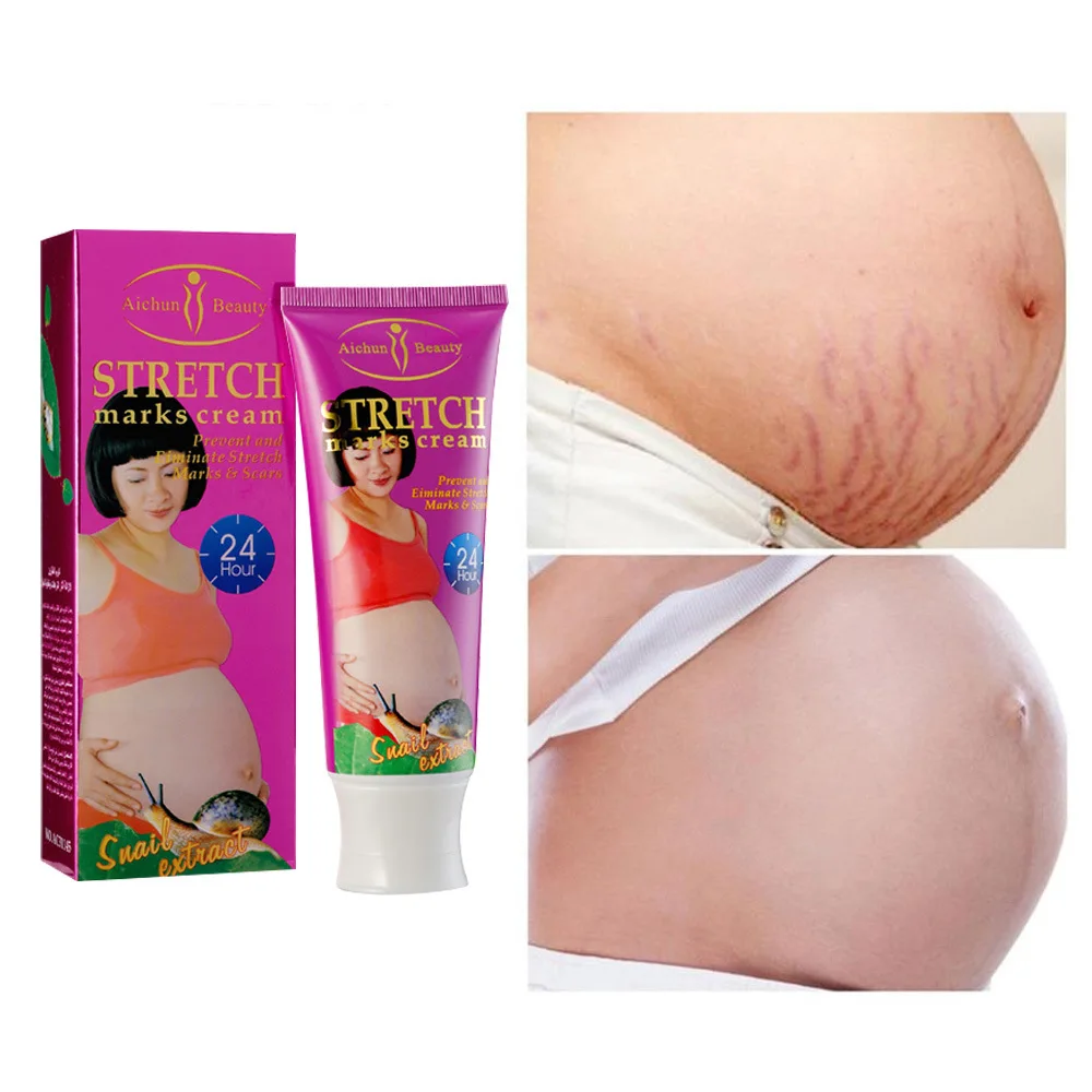 120G Snail Body Milk Desalinates Watermelon Pattern STRETCH marks cream Prevention of stretch marks