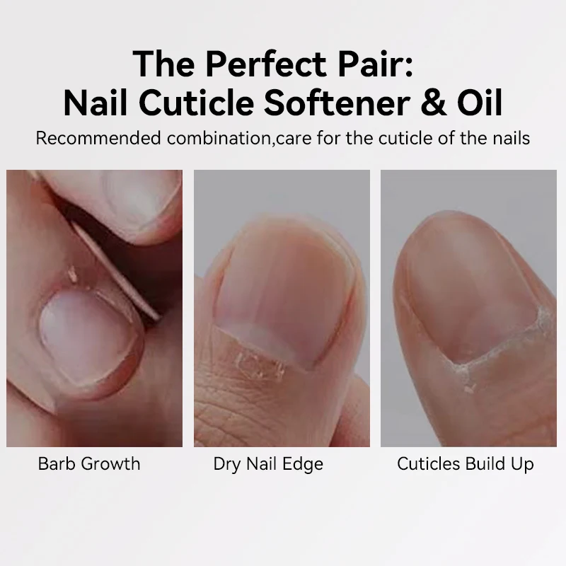 UR SUGAR 15ml Krem do pielęgnacji skórek dłoni i stóp Nawilżający skórkę martwą skórę Manikiury Pielęgnacja paznokci