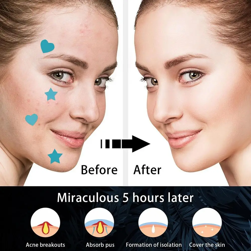 الملونة ستار بثرة التصحيح حب الشباب الملونة غير مرئية حب الشباب إزالة العناية بالبشرة ملصقات المخفي الوجه بقعة أدوات ماكياج الجمال 600 قطعة
