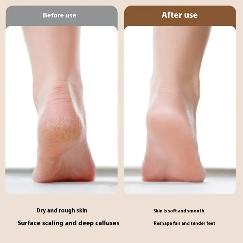 

Электрический инструмент для удаления мозолей на ногах, инструменты для педикюра, пилка для ног, гладкая машина для пяток, омертвевшая кожа