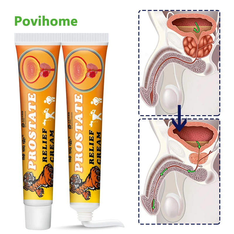 

20g Sumifun Prostatitis Ointment Male Urinary Prostate Urological Urethritis Treat Cream Man Body Medical Health Care Plaster