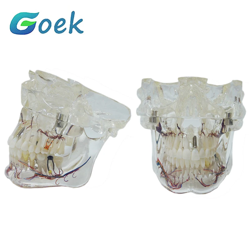 

Dental Clear Pathological Model With Nerve C13 Teaching Resources Dentist Accessories Tools Model Teeth Dentistry