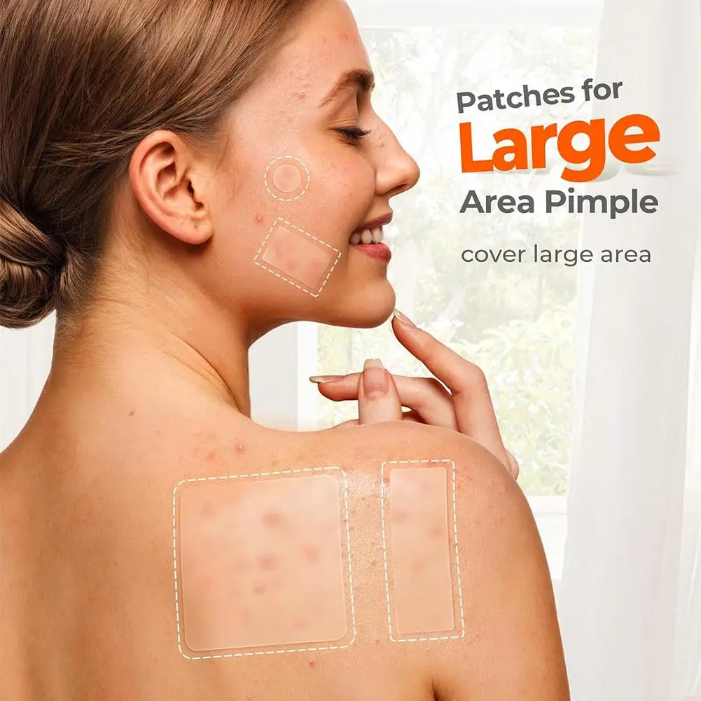 Acne Patches Invisible Pimple Cover for Face And Body Oil Control Spot Treatment Cute Sticker for Covering Zits And Blemishes