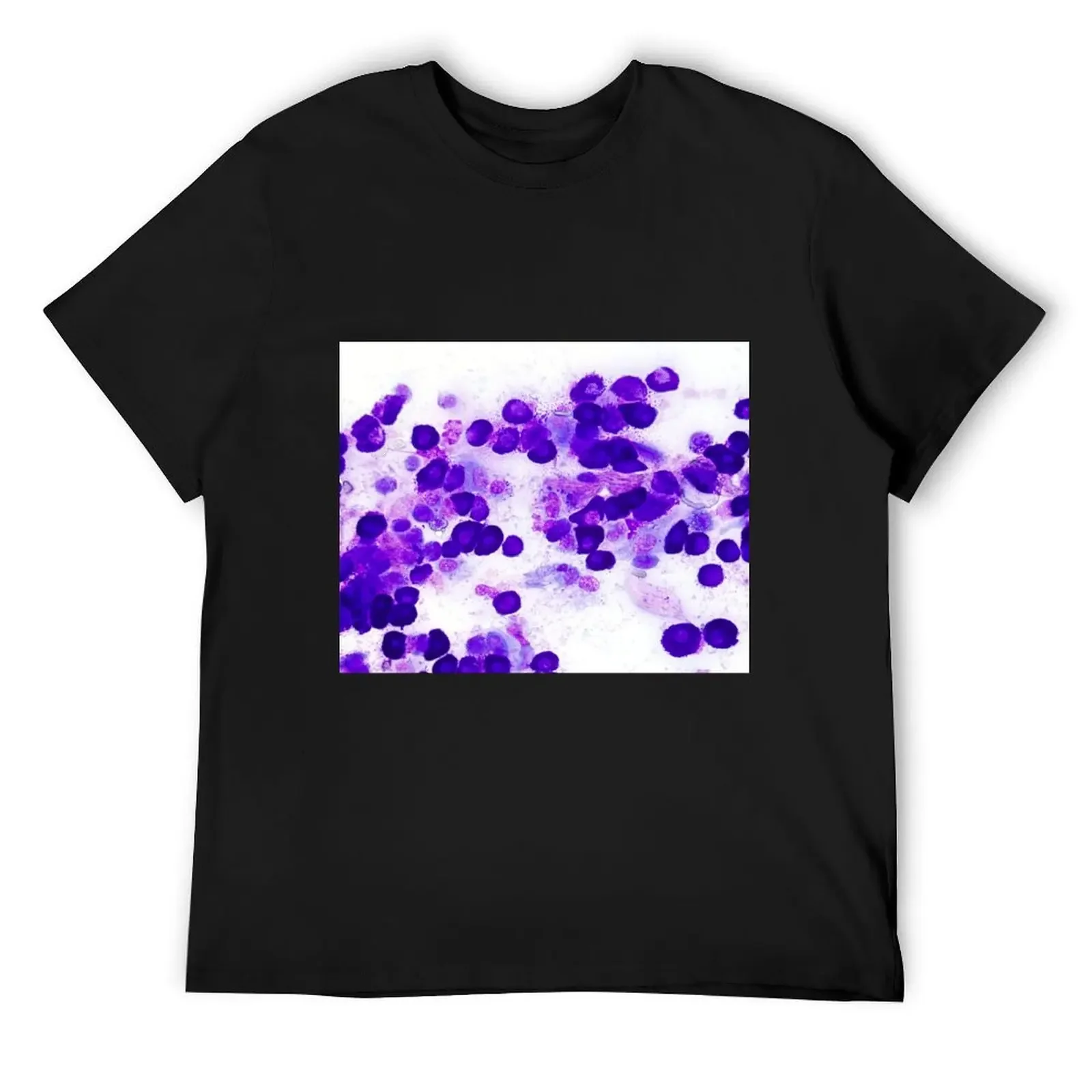 Mast cell tumor (MCT) T-Shirt baggy shirts graphic t shirts aesthetic clothes sports fans big and tall t shirts for men