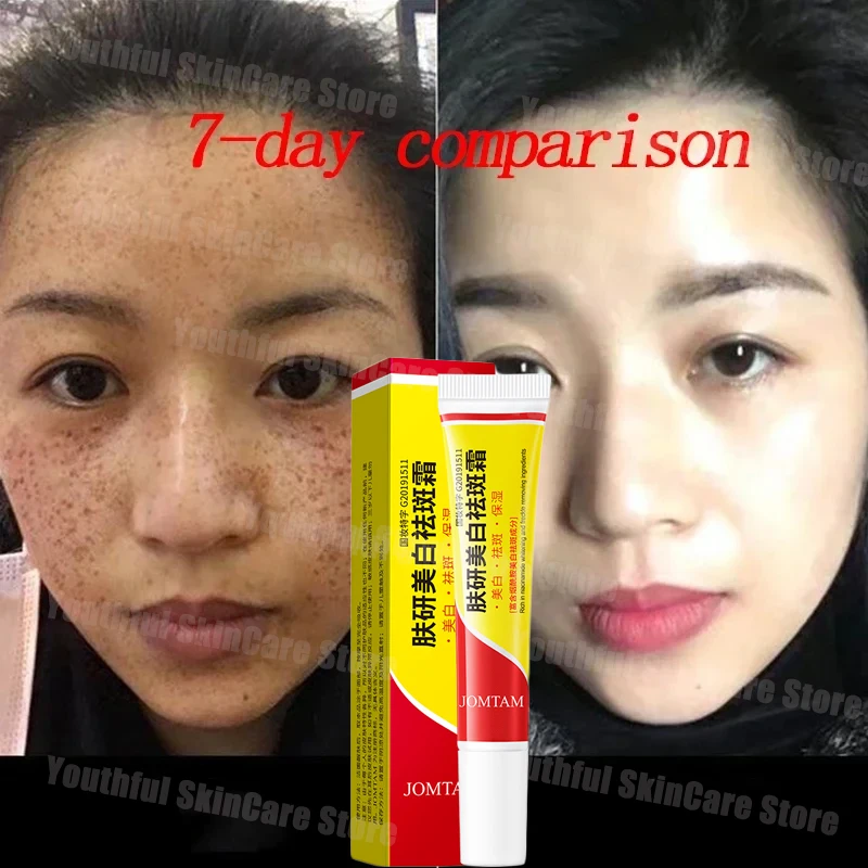 Face Brightening Cream Niacinamide Reduce Chloasma Melasma Melanin Fade Fine Lines Lighten Dark Skin Serum Care Brighten Cream