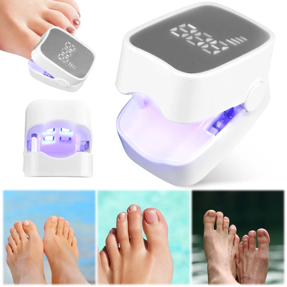 

Светильник от грибка ногтей Устройство для извлечения грибка ногтей Портативное решение для грибка ногтей USB-зарядка для грибка ногтей на ногах и онихомикоза