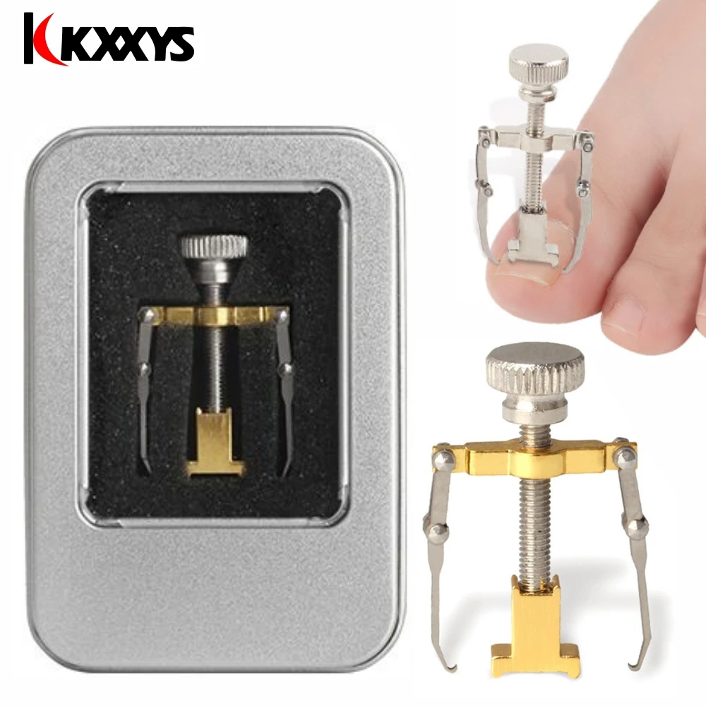 1Pcs Ingegroeide Teennagels Fixer Orthesen Toe Nail Herstellen Orthesen Correctie Tool Voetverzorging Apparaat Manicure Pedicure Set Machine