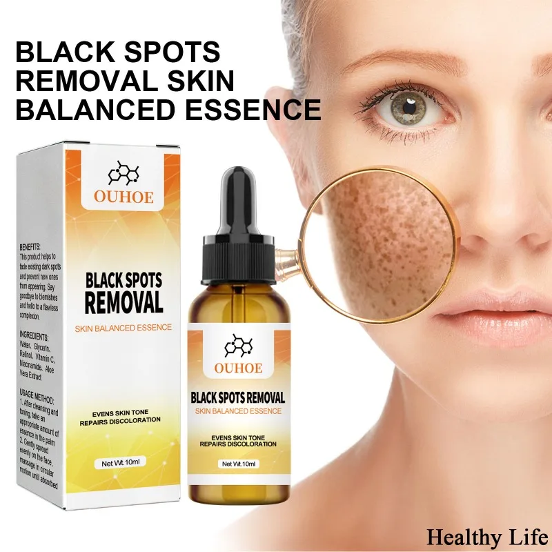 Skin Whitening Freckle Serum Retinol Brighten Anti-Aging Essence Niacinamide Vitamin C Fade Spots Product Women Face Whiten Care