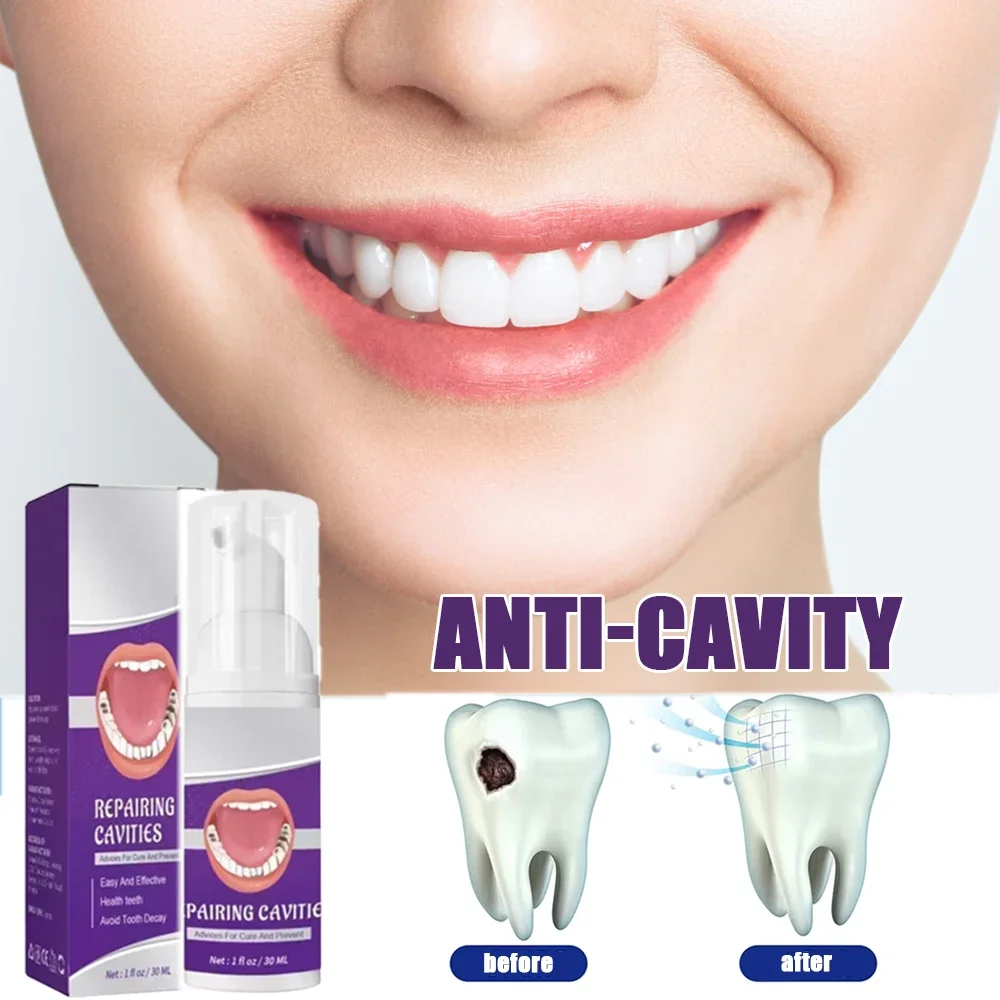 

Toothpaste of Teeth Whitening Repair of Cavities Caries Removal of Plaque Stains Decay Repair Teeth Treating Dental Calculus