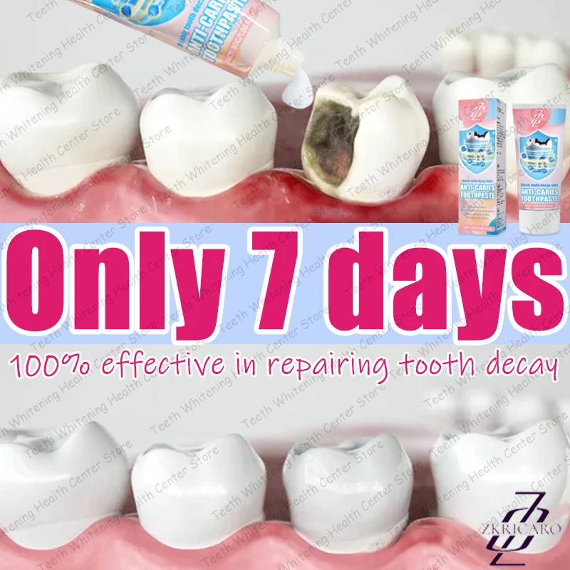 99% of people repurchase, hot selling, repair tooth decay.