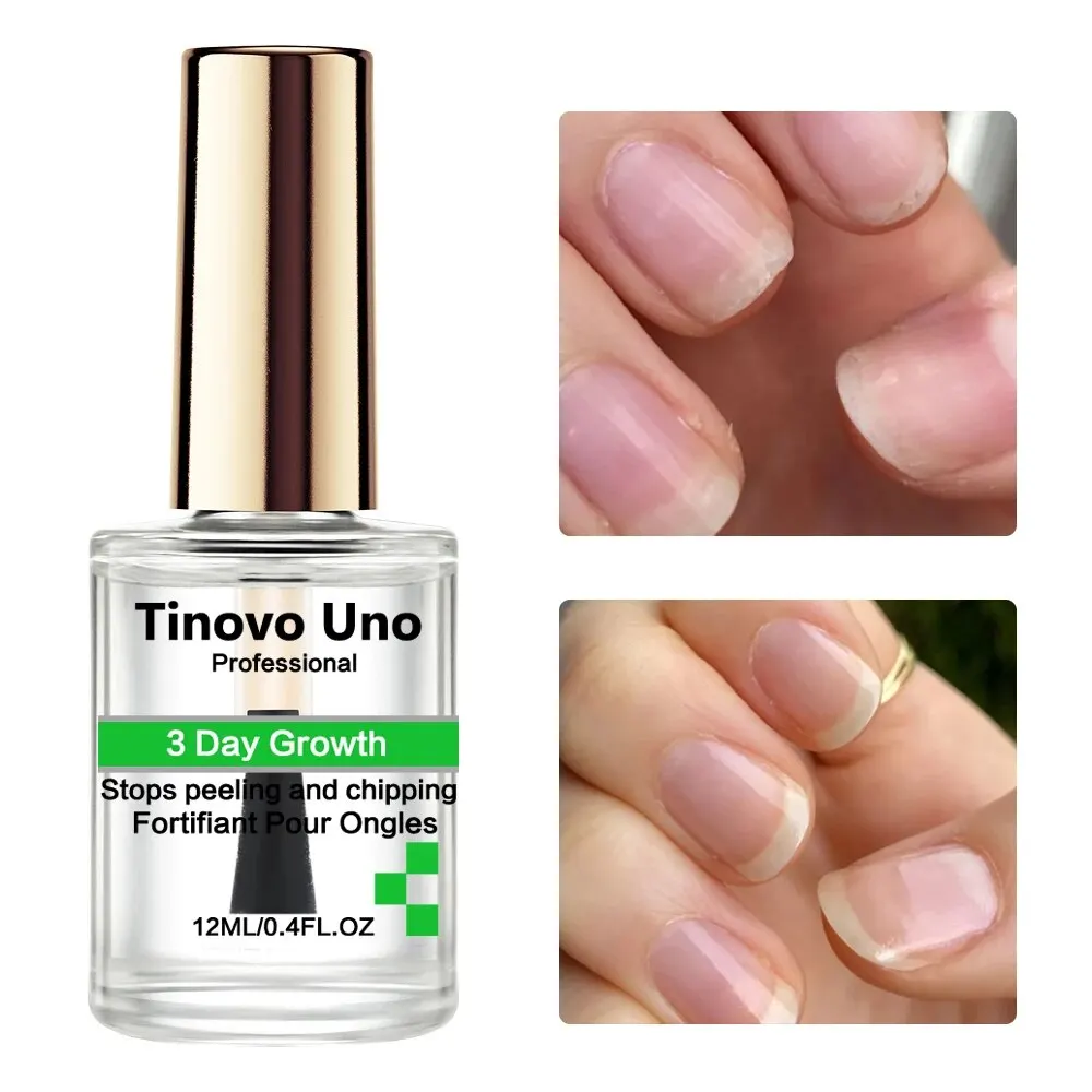 علاج نمو الأظافر Tinovo Uno لمدة 3 أيام ، تصليب الأظافر الكيراتين السريع ، تقوية للإصلاح ، الأظافر الرقيقة الهشة ، أدوات العناية بالأظافر