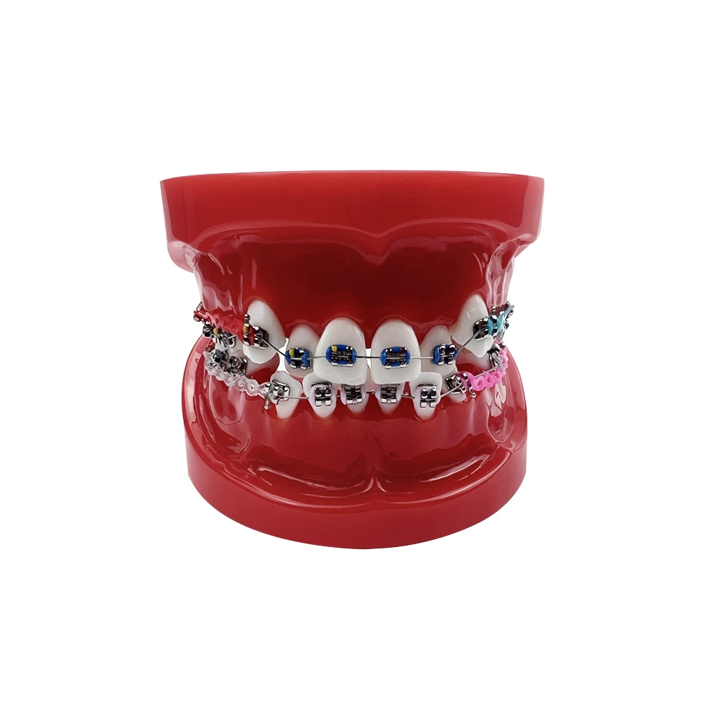 Orthodontic Dental Teeth Model With All Metal Bracket Ortho Model For Teaching Education Display Dentist-Patient Communication