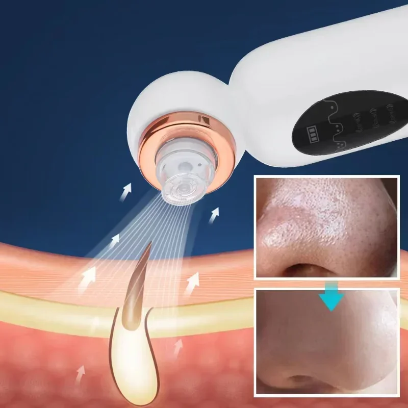 

New Electri Blackhead Remover Vacuum Suction Small Bubble Face Nose Cleaner Water Cycle Pore Acne Pimple Removal Vacuum Suction