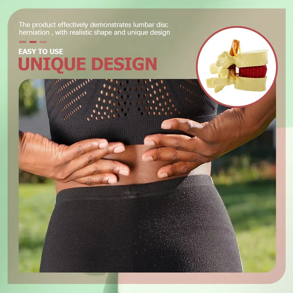 PVC Lumbar Disc Herniation Spine Model Realistic Shape Portable Perfect Teaching Demonstrating Human Anatomy Medical