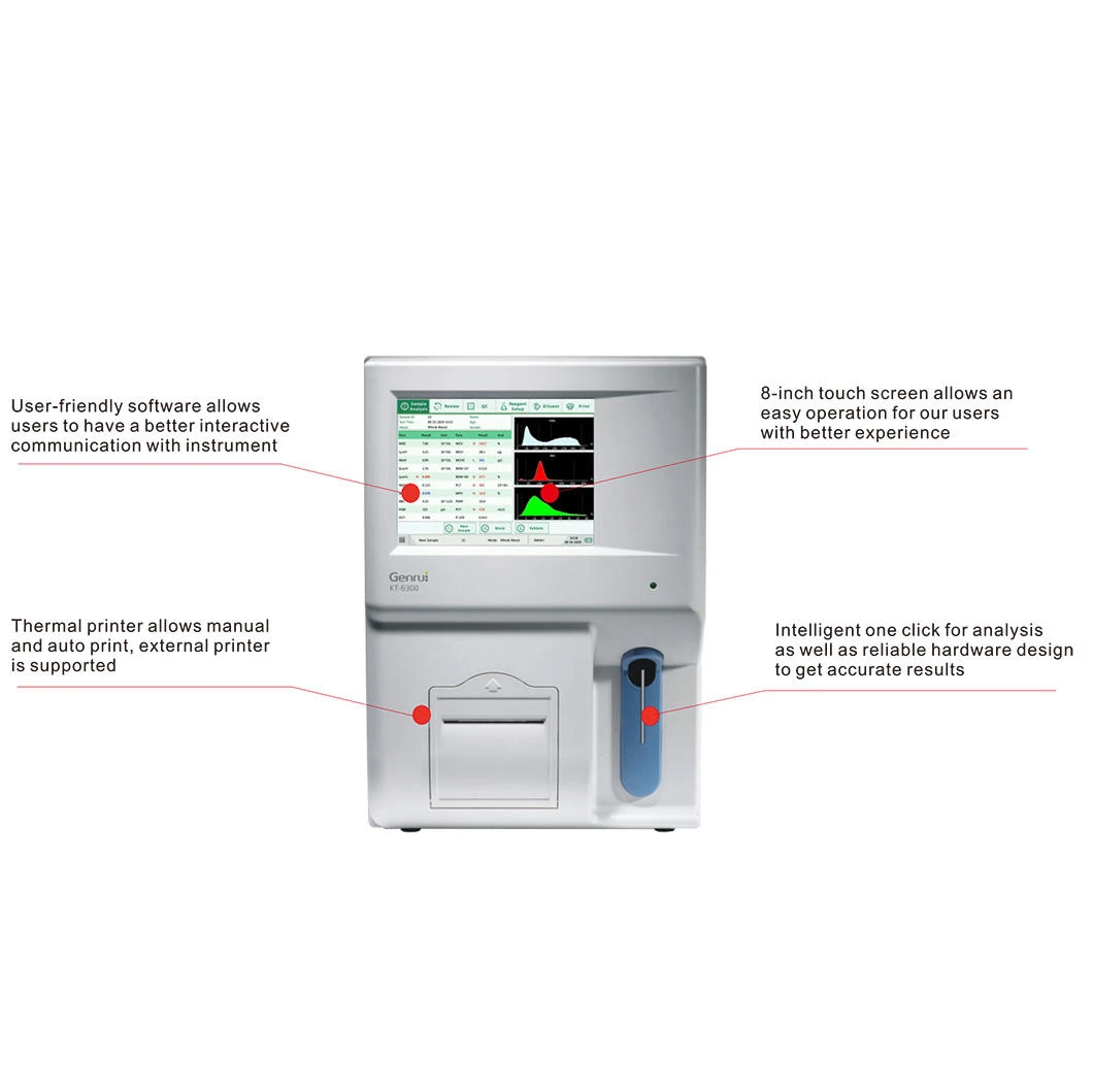 CE Certified Medical Hospital Laboratory 60 Samples Per Hour Open Reagent System 3 Different Automatic Hematology Analyzer