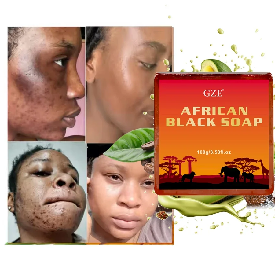 GZE AFRICAN BLACK SOAP with Shea Butter & Coconut Oil & Kernel Oil, for Dry Skin and Skin Conditions, Body Wash Even Skin Tone