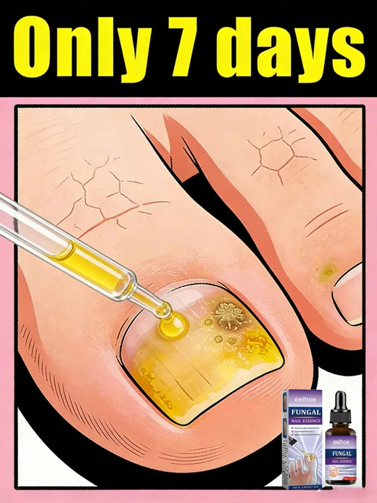 

885ht Rejuvenator - Fungus Prevention Technology - Adjustable Temperature Control & Safety Sensor