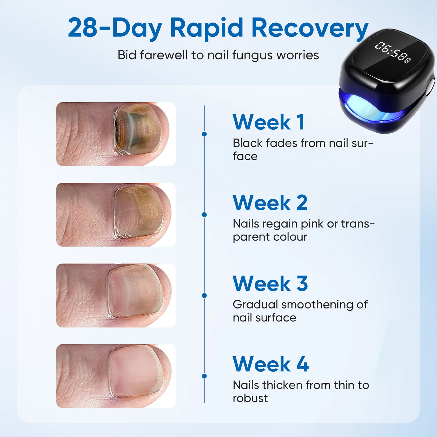 Onychomycosis Nail Laser Fungus Device Portable Nail Fungus Therapy Laser Device Repair Damaged Anti Fungal Tools USB Charge