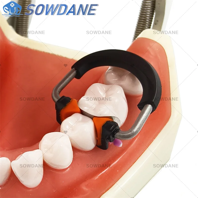 Dental NITI Clamping Ring Fit Palodent V3 System Nickel Titanium Sectional Matrice Band NITI PEEK Flexible Dentistry Tool - view 3