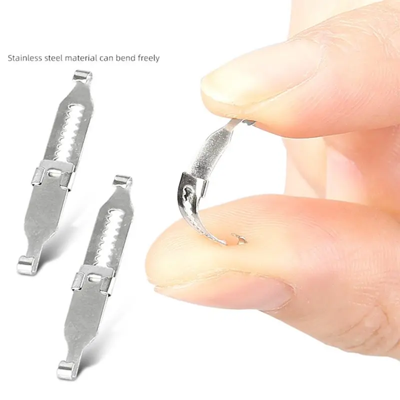Ingrown Toenail Correction Corrector Tool Professional Pedicure Recovery Embedding Toe Nail Foot Care Solution-A77G