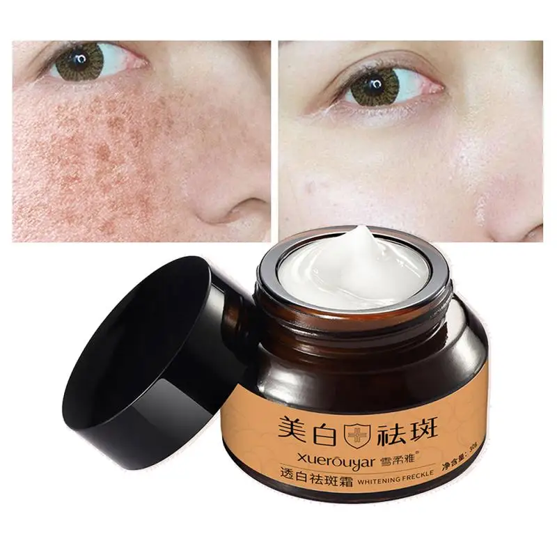 Crema blanqueadora coreana para el cuidado de la piel, crema brillante para el rostro, fórmula efectiva, crema para pecas más vendida, crema coreana para el cuidado de la cara