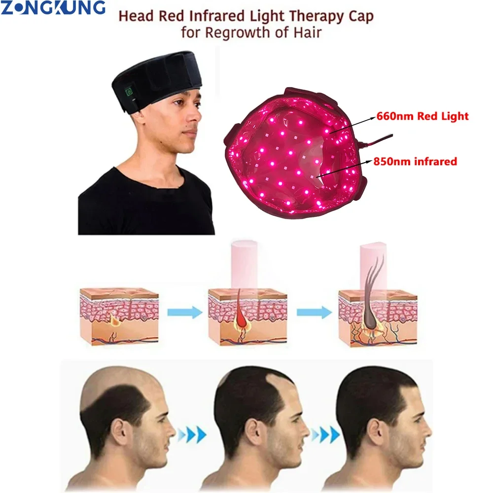 

Red Light Infrared Therapy Cap for Treatment Seborrheic Alopecia Areata Hair Growth Red Hair Growth Hat Device 635nm&850nm