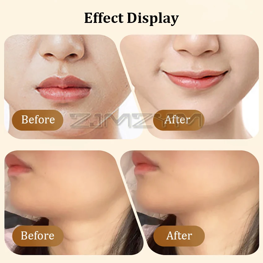 Masajeador de elevación de ojos Facial, máquina de estiramiento de la piel, masajeador de rejuvenecimiento Facial, cuidado de la piel, eliminación de arrugas, dispositivo de Estiramiento Facial