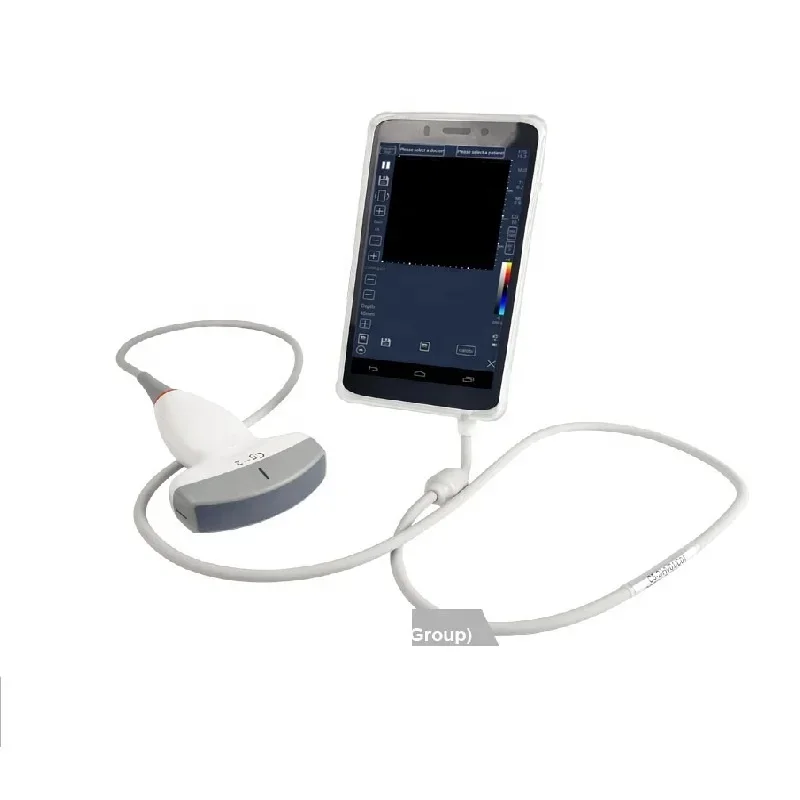 Sonography Diagnostic Scanner with CE ISO Por hine and medical