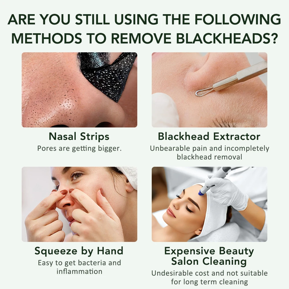 Mini dissolvant de points noirs Portable, épurateur de peau du visage, outil de nettoyage des pores, extracteur de points noirs, dispositif de soins du visage