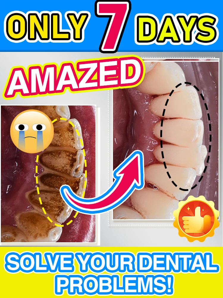 

30ml whitening foam toothpaste, oral health care, protect teeth