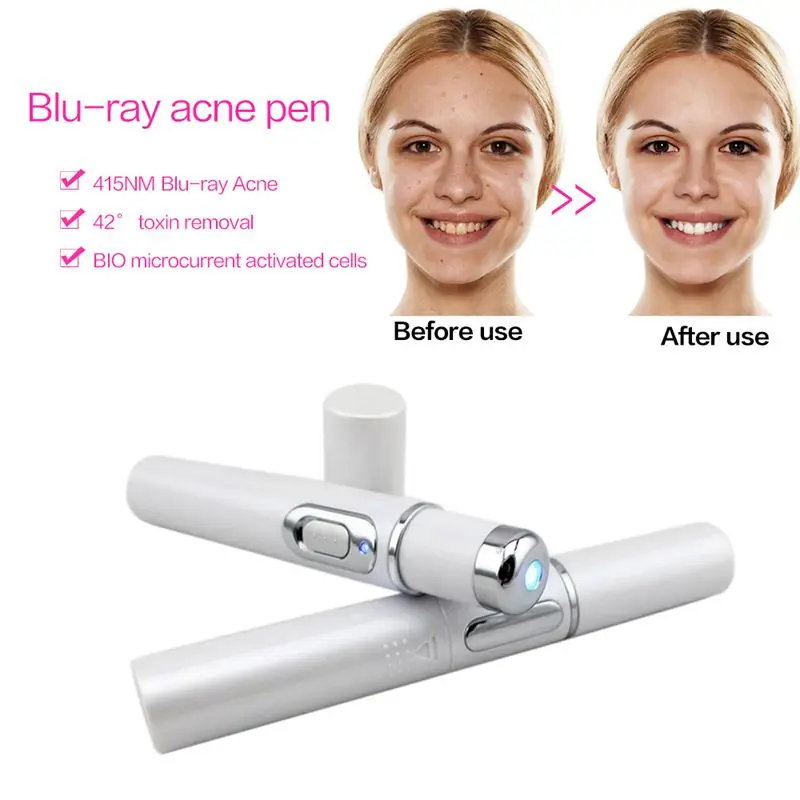 Mini Blue Light Acne Pen Eye Massager Anti-Pouch Black Eye Massage Stick Eye and Face Beautifying Instrument