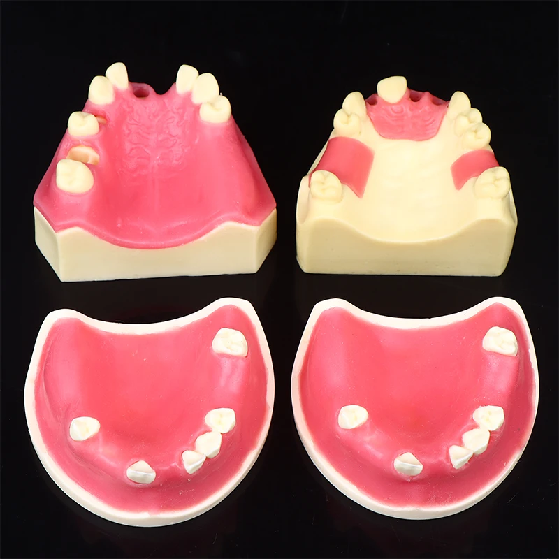 نموذج فقدان الأسنان زرع الأسنان طالب التدريب التدريب المعونة ممارسة نموذج العلوي الفك رفع يزرع استعادة نموذج مختبر