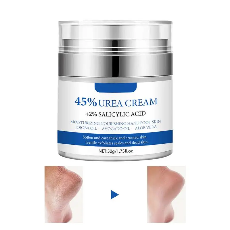 

Dry Hand Foot Cream Natural Hand And Foot Moisturizing Cream With Plant Extracts Cold Days Beauty Products For Business Trips