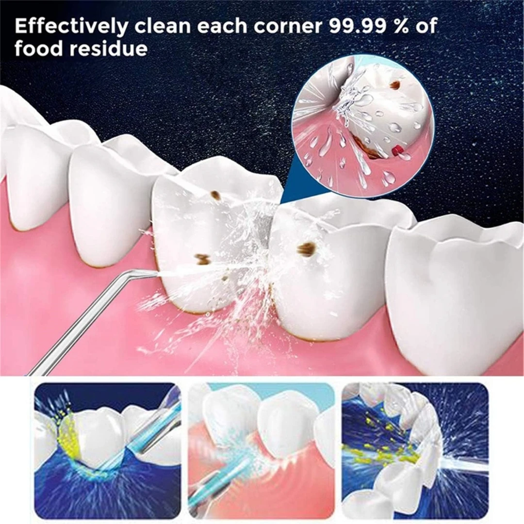 80ML/110ML Water Flosser Hand-Powered Oral Irrigator Water Flosser Nozzles and Tongue Scraper Kit for Teeth Braces