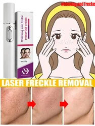 Macchie scure Laser Melasma lentiggini sbiancamento del viso