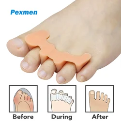 Pexmen 2Pcs Gel Toe Separators Toe Spacers Spreaders Straighteners to Relieve Foot Pain and Correct Toes for Men and Women