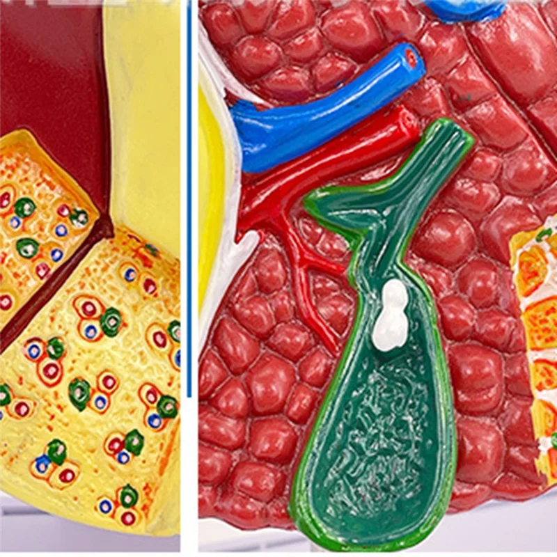 

Liver Model Human Anatomy Liver Model For Common Pathologies, Liver Model Human Anatomy Office Anatomy Model