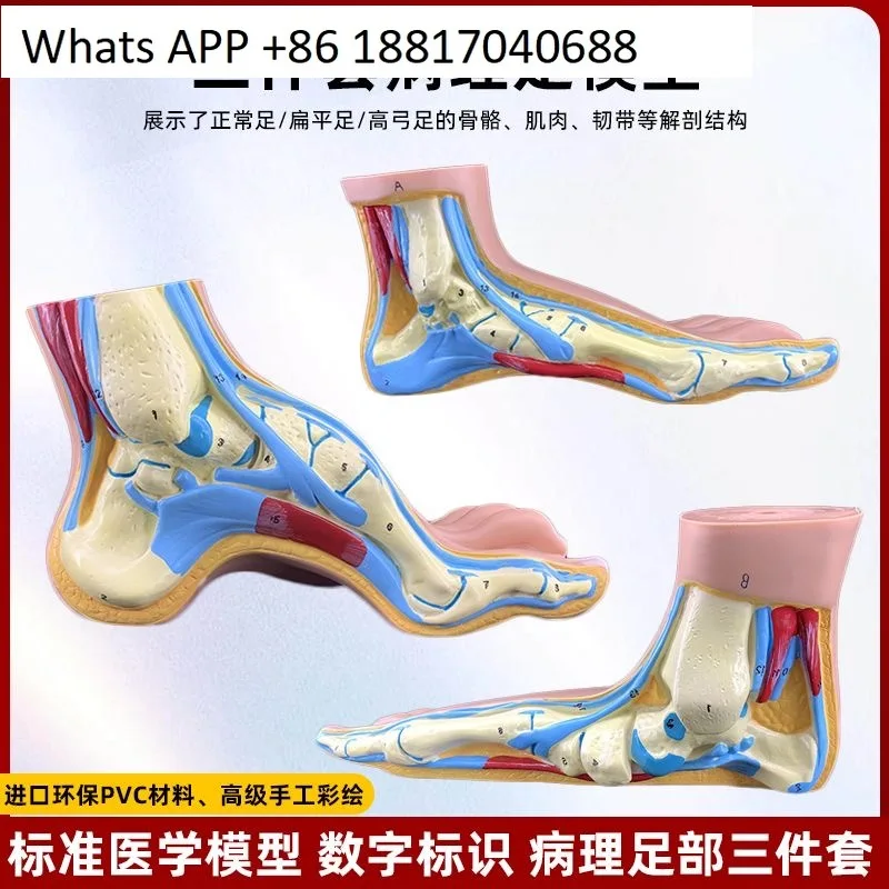 

Имитация человеческой стопы. Анатомическая модель. Нормальная обработка плоскостопия. Конструкция мышц. Медицинские учебные пособия.