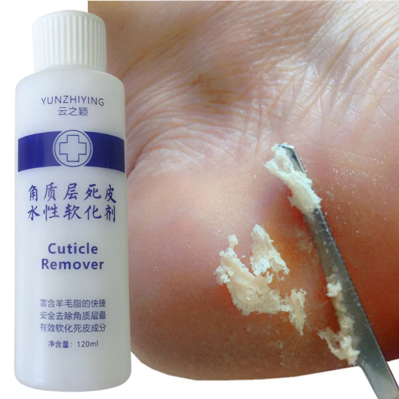 120ml pé cutícula esfoliante amaciante pé odor remover pele morta pé coceira peeling calos máscara de pé pedicure intensificador de unhas