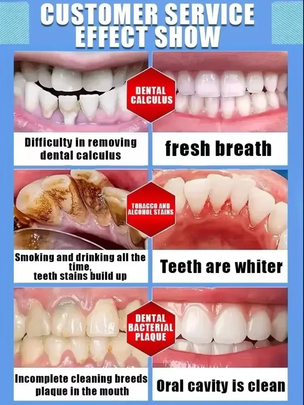 إصلاح الأسنان، ويمنع تساقط الأسنان، وإزالة لوحة الأسنان بشكل فعال #5