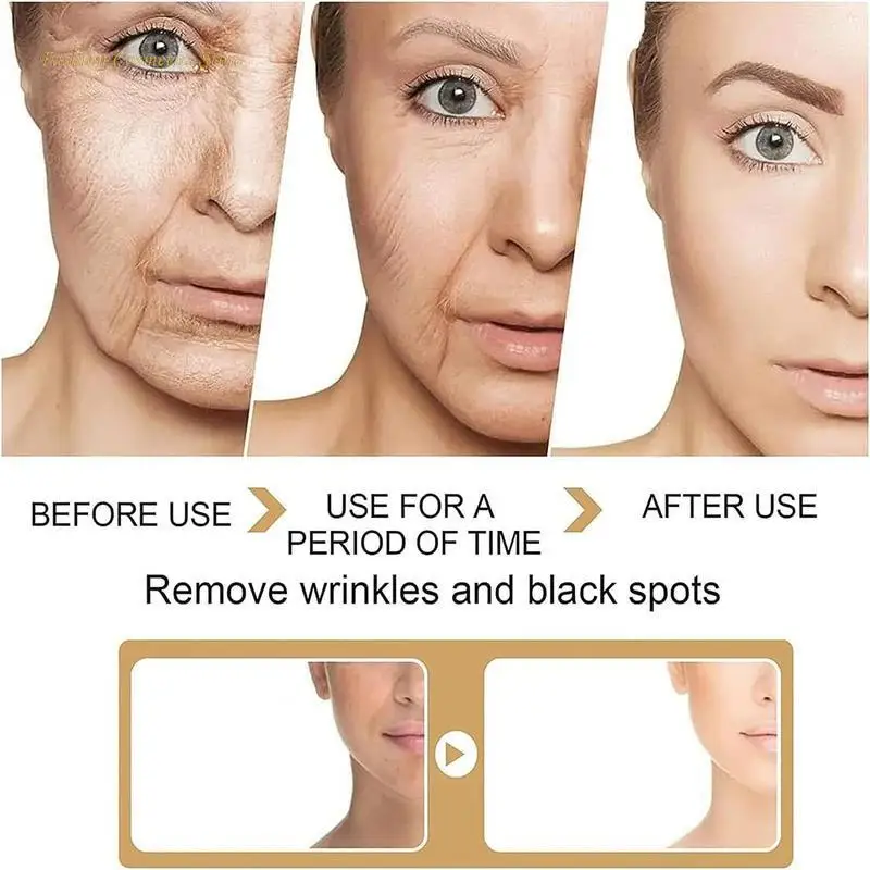 Black Spot Remover Serum Whitening Brightening Freckle Fade Dark Spot Removal Serum Freckle Whitening Serum Face Skin Care