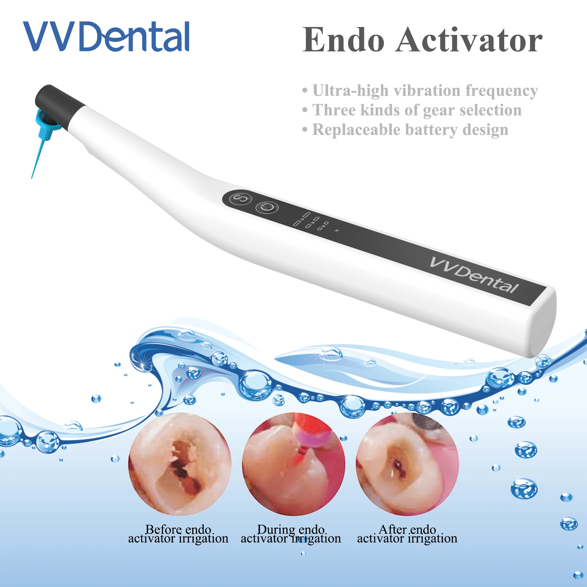 

VV Dental Root Canal Orthodontic Sonic Irrigator Activator with LED Light 30 PCS Tips Endodontics Cleaner Kit Dentistry Deals
